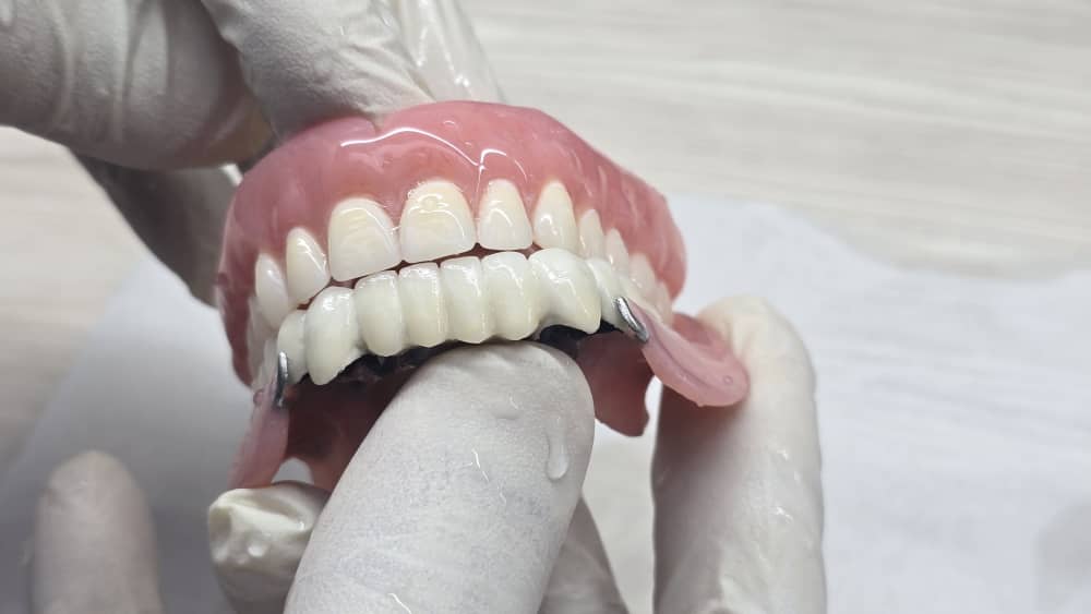 تعمیر دندان مصنوعی