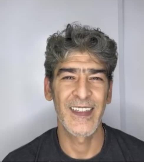 تهیه دندان مصنوعی با لثه نرم