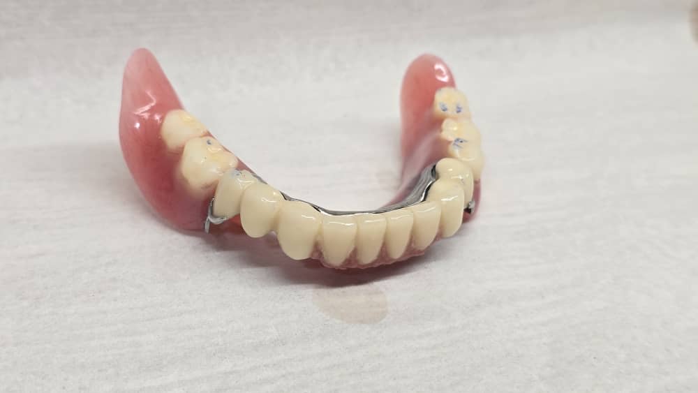 تفاوت دندان مصنوعی کامل و جزئی