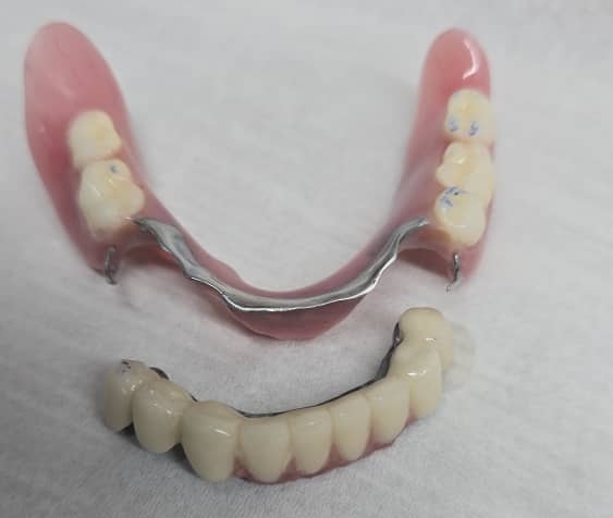 پروتز دندانی: معرفی و کاربردها