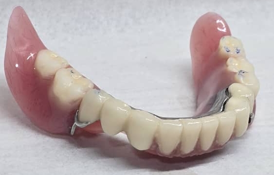 مراحل ساخت بریج دندان: راهنمای کامل گام‌به‌گام