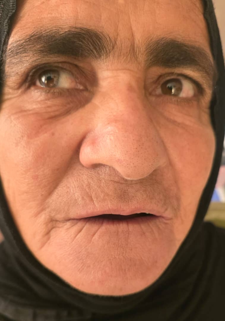 دنچر پارسیل آکریلیکی