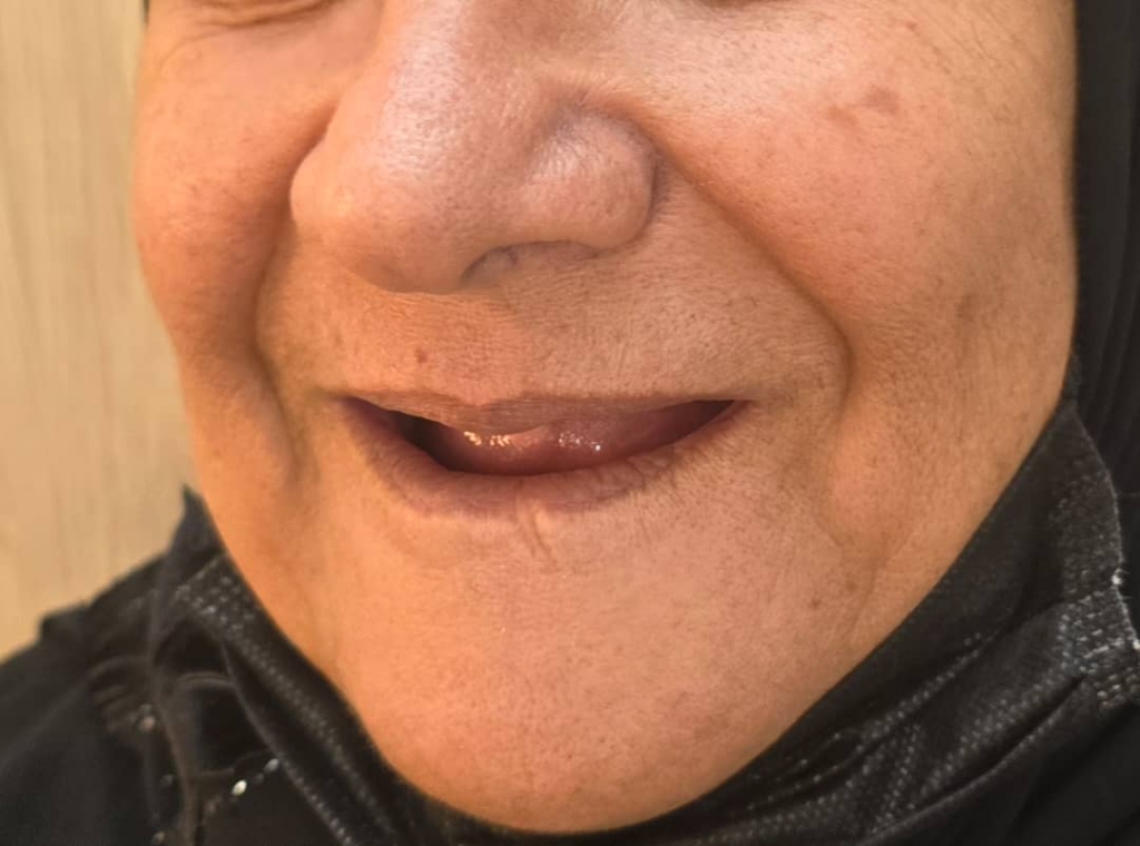 دنچر پارسیل آکریلیکی