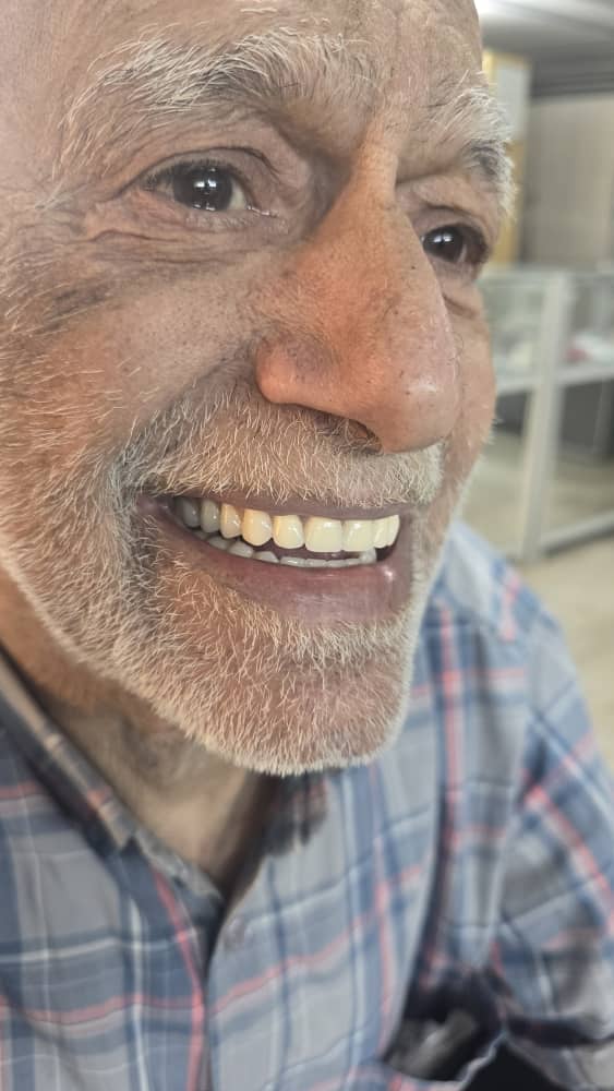 دنچر پارسیل انعطاف‌پذیر