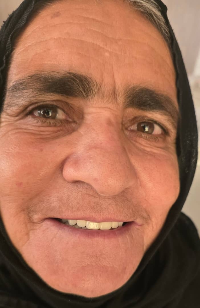 دنچر پارسیل آکریلیکی