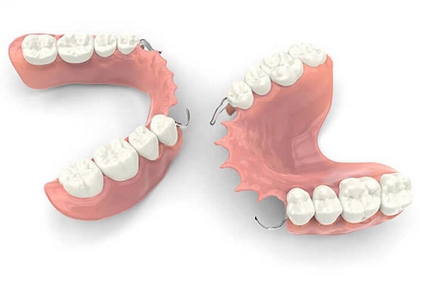 پروتز متحرک دندان چقدر دوام دارد و چه زمانی باید تعویض شود؟