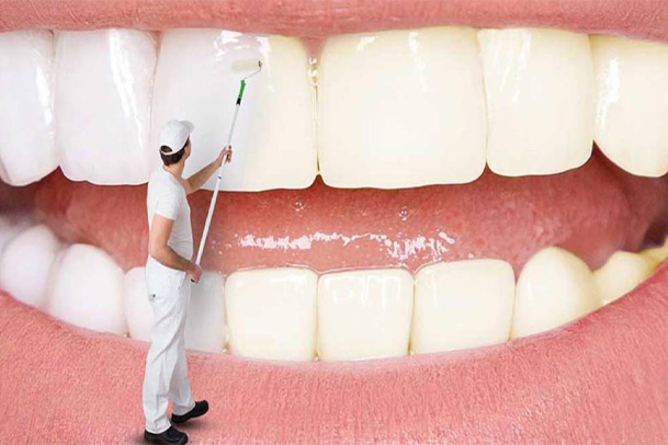 روش‌ های حرفه‌ ای سفید کردن دندان‌ ها با ایمنی کامل – راهنمای جامع